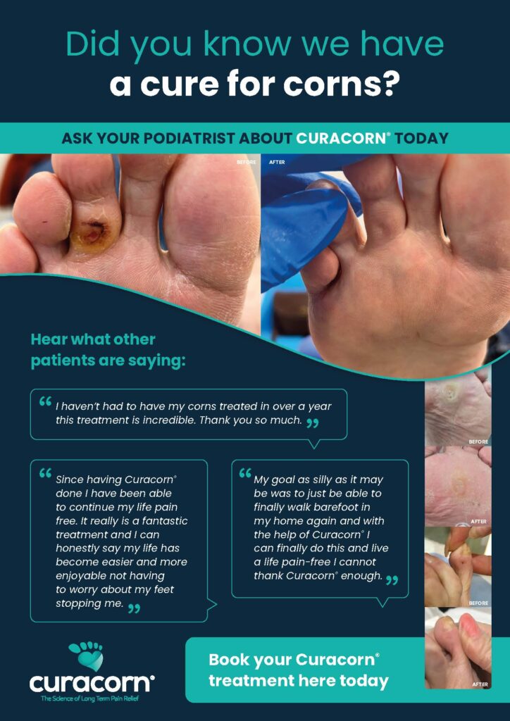 Curacorn treatment from Coventry Foot Clinic